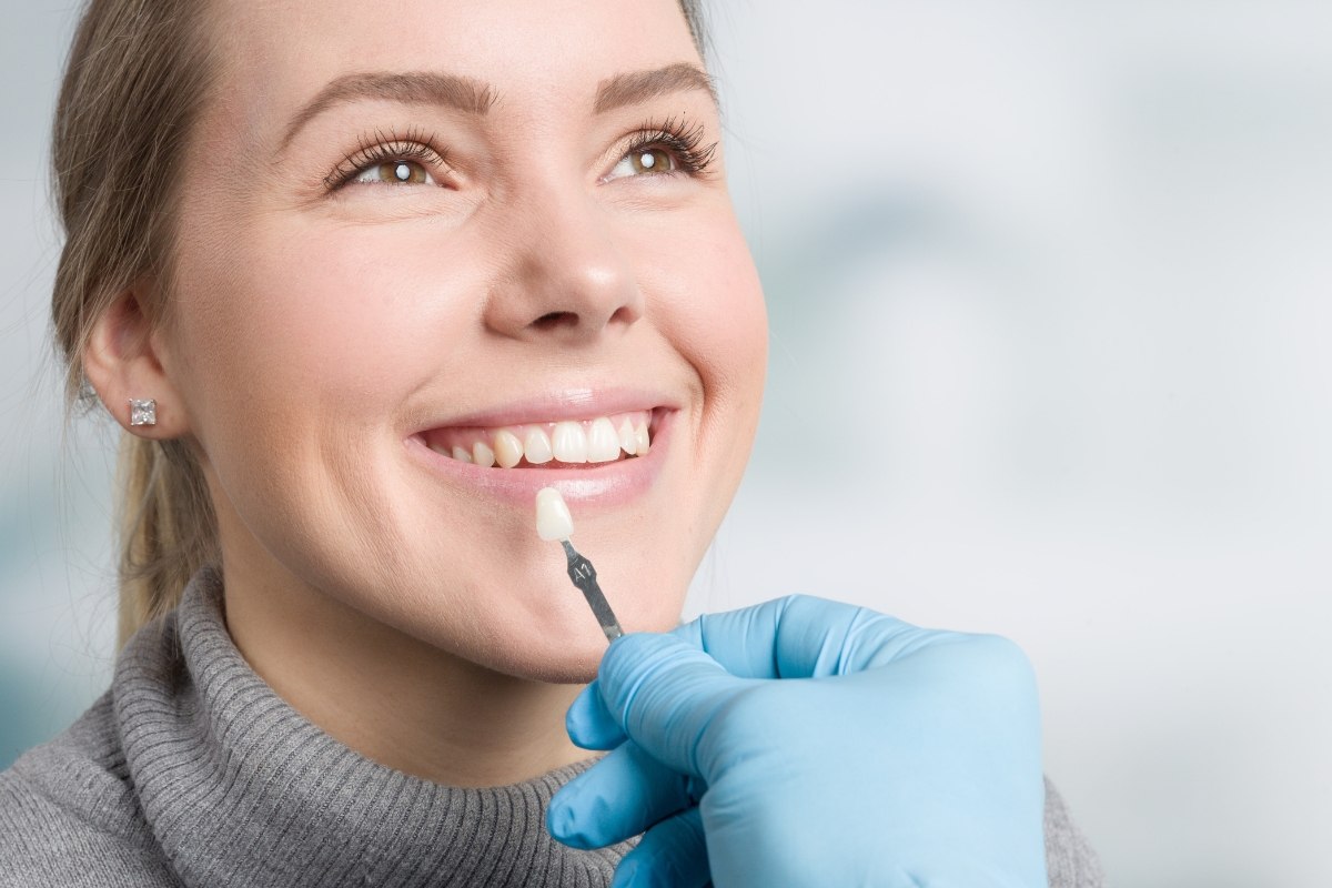 veneers-in-San-Antonio